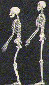 #La Chapelle skeleton
